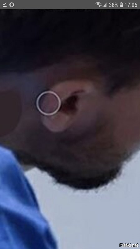 Что за кольцо в ухе и почему так расположено?
