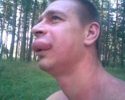 Один раз в губу оса ужалила, можно было чайную кружку на губе повесить !