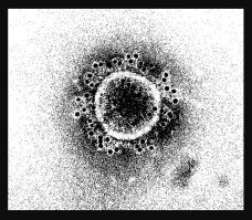 Вирусная частица MERS = NIAID = flickr = CC BY 2.0