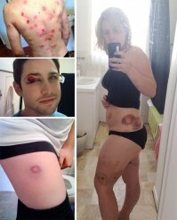 Кто-то чешет по ушам. Вот с пейнтбольного форума.