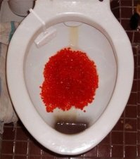 т.е. вот это красное в унитазе это боль, а коричневый след от вечно текущей воды это нормас!?