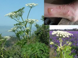 Давно всем предлагаю под окнами сажать это, синяки оценят, когда будут в кусты ходить ссать.