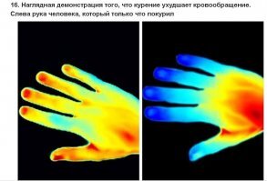 Так всё-таки слева или справа?