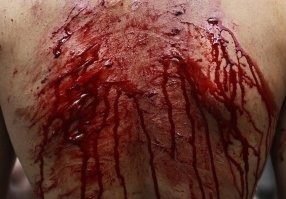 На фото Шииты... Так отмечается шиитский праздник "Ашура" - день траура по мученической смерти Хусейна ибн Али, внука Мухаммеда в битве при Кербеле. 
Верующие травмируют себя ножами, цепями, и плетями.  Траурные церемонии в День Ашура проводятся в Иране, Азербайджане, Афганистане, Таджикистане, Ливане, Пакистане, Бахрейне и других странах Персидского залива, а также в Греции, где образовалась большая шиитская диаспора (греки, кстати в аху-е от них).