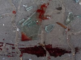 Хоть не порезались?