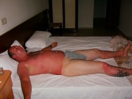 17 фотографий людей, которые перестарались с загаром