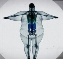 Это тебе твоя подруга что ли втирает про широкую кость?