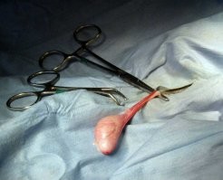 Нападение мужчины на девочку в омском подъезде