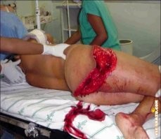 Выдержать то он выдержит, при условии равномерного давления на поверхность. 
Вот только в момент, когда встают ногами на унитаз, и слезают с него, весь вес сосредоточен в одном месте, и с краю, за пределами более узкого основания. Лопнувшее  место крепления унитаза, или плохо закреплённый унитаз - и он под твоим весом заваливается на бок вместе с бачком. А ты плюхаешься на него сверху. И в таком случае остаётся только уповать на то, что унитаз и бачок не разобьются при падении.
Иначе будет примерно так: