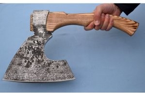 Как лечить вросший ноготь на ноге