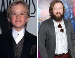 Думаю, что тут многое зависит от типа лица. Лицо бывает откровенно детское и не меняется с возрастом. И ничто, кроме, наверное хирурга не сможет это изменить. Вот еще яркий пример: