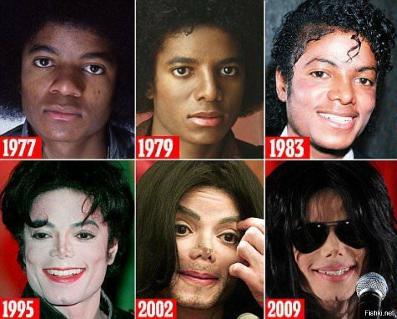 Я не поклонник творчества Джексона и не обязан следить за перипетиями его жизни. Я и не следил. Витилиго так витилиго. От отца так от отца. Хотя я не очень верю во всё это, много тут странного. Странный человек и жизнь у него странная.