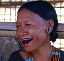 Что она там отбеливает? Зубы и так белее белого. Дура што-ле?
Вот эти пусть отбелить попробует.