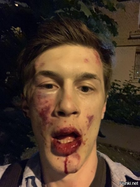 А кровищей то измазался... А толковых побоев на роже то нет, даже вафли толком не разбили... и куда катится мир, даэе дрища толком отаварить не могут...