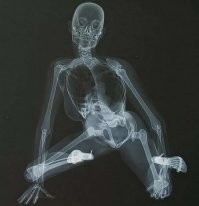 16 удивительных рентгеновских снимков