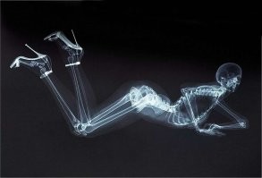 16 удивительных рентгеновских снимков