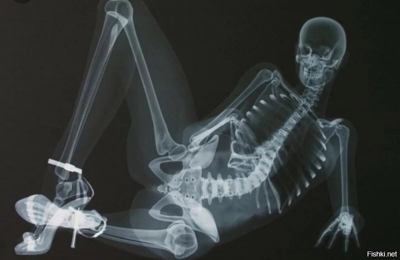 16 удивительных рентгеновских снимков