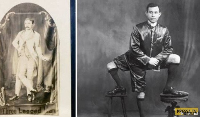 тут вот еще какие конечности
хотя фик с ними с ногами и пальцами ..а вот два рабочих набора