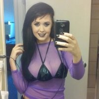 Непохожие на других: люди с биологическими аномалиями