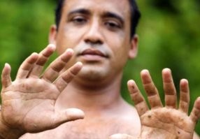 Разве это аномалии, вот аномалии!