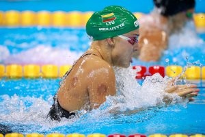 Многие спортсмены ставят банки. Улучшает кровообращение в мышцах.