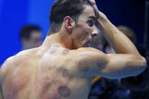 Многие спортсмены ставят банки. Улучшает кровообращение в мышцах.