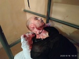 А перед смертью у него талант писателя проявился.  Ещё экспертизу пообещали сделать.  И тут я вспомнил, а что же пишет про экспертизы мой любимый детский писатель Олег Дерипаска?  
А пишет он вот что. Цитата.
"...Один профсоюзный лидер пошел против правил, и стал нас шантажировать – пытался отнять глиноземный комбинат, поднять рабочее движение, журналистов, ну и все такое прочее. Цена вопроса от профсоюза – около четырех миллионов долларов. Для меня цена вопроса – стоимость комбината. Около 1,5 миллиарда. Платить мы конечно же не стали. Этот бедолага, Смоленцев, не учел, что Ачинск – очень криминальный город. Мы всего лишь сняли с профсоюзника всю защиту государства на некоторое время. И почему власть должна защищать тех, кто против нее? И вот криминал узнал про четыре миллиона. Начались акции. Струсил профсоюзник, стал бегать от бандитов, и активисты его попрятались. Некоторое время спустя пошел купаться на пруд, а сердечко от стресса не выдержало – утонул. Вышло смешно. Труп нашли. Собрался профсоюзный актив – крики, почему у трупа вся голова и шея сзади якобы сплошной кровоподтек, ногти на руках сорваны – вроде бы пытали и убили его. Работал судмедэксперт, я сам просил Владимира Васильевича Устинова, генпрокурора, проконтролировать… Результат очень профессиональным получился, его донесли до публики. Человек плыл, пруд довольно большой, метров сорок. Глубина метра два. Ветер дул, волна большая. Сердце не выдержало у профсоюзника. Он задыхался, но еще карабкался по берегу, ногти срывал. А когда обессилел – его волной било о прибрежный камень, головой и затылком. Отсюда гематома на трупе, а не от бандитских пыток. Всякие общественники шумели, обвиняли нас, три раза уголовное дело возбуждали – результат тот же. Умер от приступа. 
Теперь нет у нас проблем в Ачинске. Комбинат наш. Журналисты и профсюзники переехали в другие города, посбежали. 
Так что не стоит доводить дело до массовых беспорядков, нужно действовать с упреждением. 
Профессионально работать надо..."

Я уверен, в деле "тесака" тоже найдутся профессиональные эксперты.  Посмотрите на фото, человек явно самоубился.