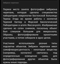 Удивительная фотография зародыша черепахи под микроскопом