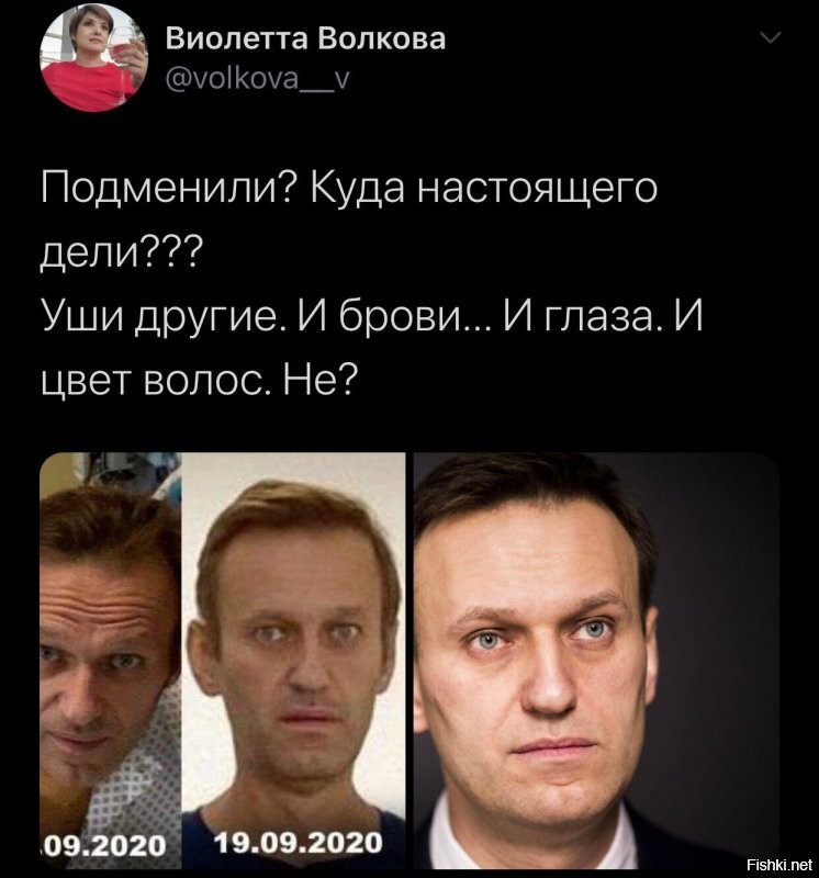Что не так с «комой» Навального — разбираем по пунктам