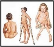 А что стесняться-то? Всем тогда засовывай, наверняка, если ты не школота, тебе родители в детстве голову дустовым мылом мыли после лагеря для профилактики. Никто тогда не знал о его канцерогенных свойствах, а вот какая дрянь полиомиелит - знали.