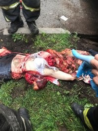 Попробуй изменить рацион питания и начни фильтровать воду которую пьешь. Из за воды это часто бывает)))) бактерии, знаете ли..... А если ты срешься от картинки в интернете, обрати особое внимание на воду. Надо выпить 12 литров залпом. Поможет, проверено)))) я знаю, меня заминусят сейчас, но я вот не срусь. Нам такое регулярно рассылают. Если что, это была женщина по которой проехал автобус. Теперь.... Это не женщина))))