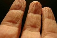 Не обязательно грести в океане. Это реакция не на греблю, а просто на воду. Защитная функция организма - когда долго находишься в воде, ступни и ладони становятся такими, чтоб меньше скользить при вылезании из воды.
Через 2 часа в обычной ванне, даже просто 2 часа под дождём и ваши пальцы будут выглядеть вот так:


Тоже самое случится и со ступнями, если пару часов походить в мокрой обуви...