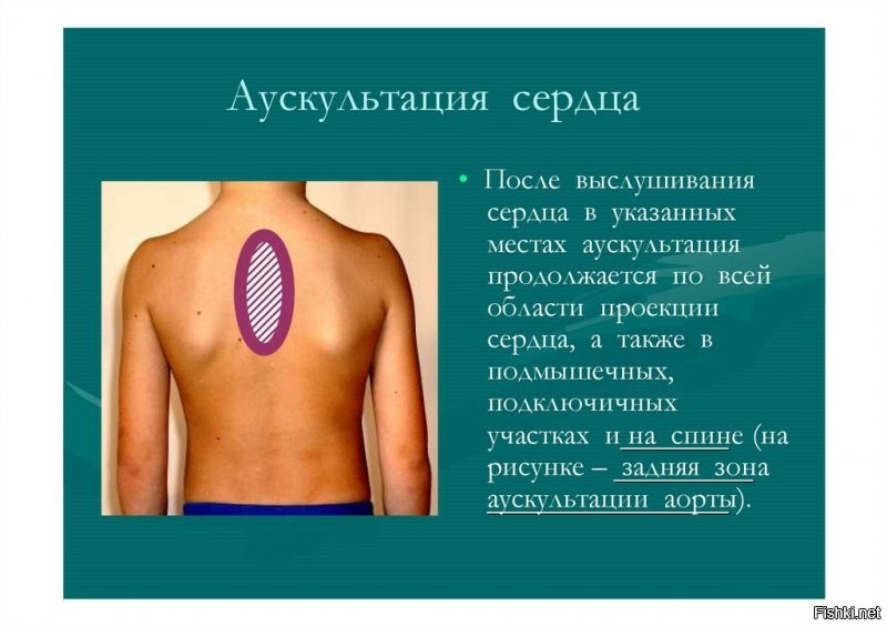 Да, ты просто тролль! Лови: