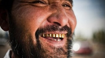 Как быстро отбелить зубы в домашних условиях