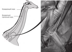 Самая забавная штука это то, что когда-то у головастиков сердце было практически в голове и нерв идущий к гортани обходил аорту и шел напрямую в пасть.
С тех пор прошло много сотен миллионов лет и головастики эволюционировали в жирафов. Но гортанный нерв все также идет 7 метров вниз, обходит аорту и возвращается 7 метров обратно к гортани.