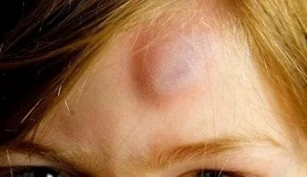 Девушка попыталась выполнить упражнение, но из-за своей неопытности проверила прочность пола