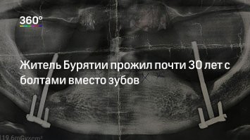 На зоне делали.