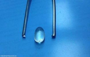 Да да ! Рукоделиями занимались как умели . А вот кстати тот самый шарик . ))