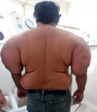 Почти все выглядит  как больные кессонной болезнью. Брррр