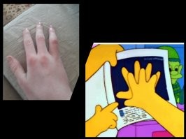 Не мутации, а особенности: люди с биологическими аномалиями