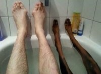 Ему бы к ортопеду...