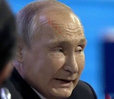 Дядю каждый месяц ботоксом колят.