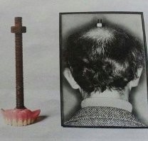 Стоматологическое: зубы болят — мочи нет