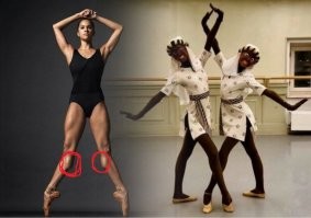 пардонте, но балет это не выступление легкоатлетов, а прежде всего эстетика тела в движении, а какую красоту можно найти в этой балерине если у неё под коленями дополнительные суставы