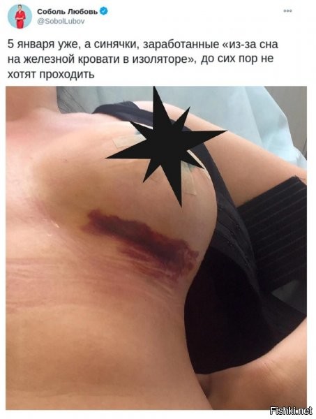 фукорцин норм тема - антисептик, как раз шрамик мазать - самое оно =))))так что тут коооомбо =)