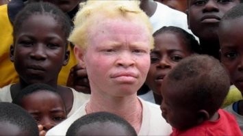 20 раз, когда чистка меняла вещи до неузнаваемости