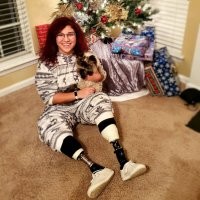 У девушки на данный момент отсутствуют обе ноги. Одну из них она решила хранить следующим образом