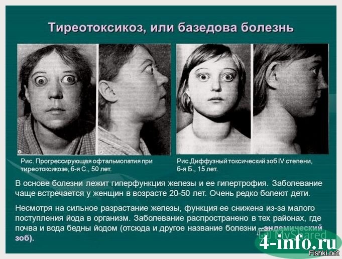 Грешно смеяться над больными людьми. У неё с каждым айфоном глаза увеличиваются, болезнь прогрессирует. Ей бы эти деньги на лечение потратить и мозги заодно поправить. Хорошо если я ошибаюсь - значит просто дура и, следовательно, неизлечима.