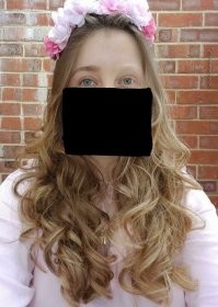 У некоторых людей тут тоже необычный окрас, бедняжки как они живут((