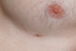 Это рудиментарные органы. Могут выглядеть как маленькая припухлость или шрамик